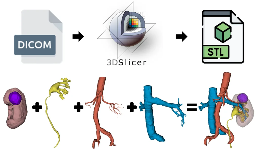Схема перехода от DICOM-снимков к 3D-модели
